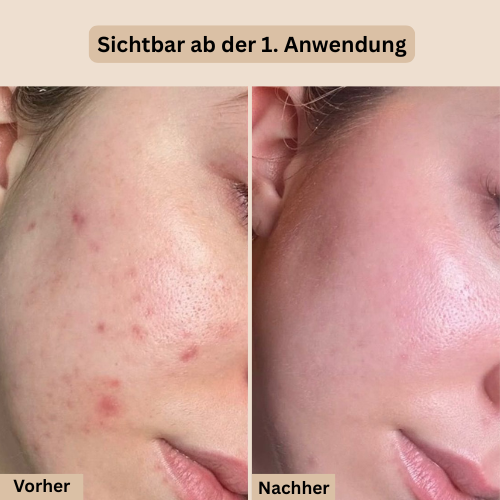 Bio - Kollagen Gesichtsmaske